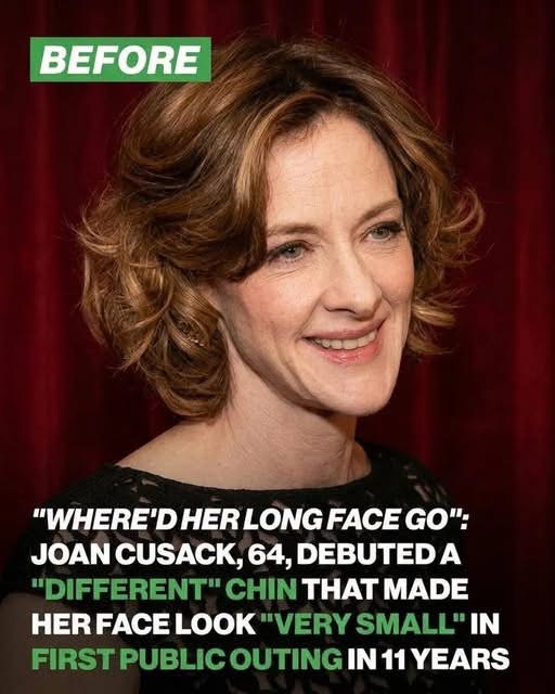Joan Cusack's Surprise Red-Carpet Return Has Fans Buzzing!