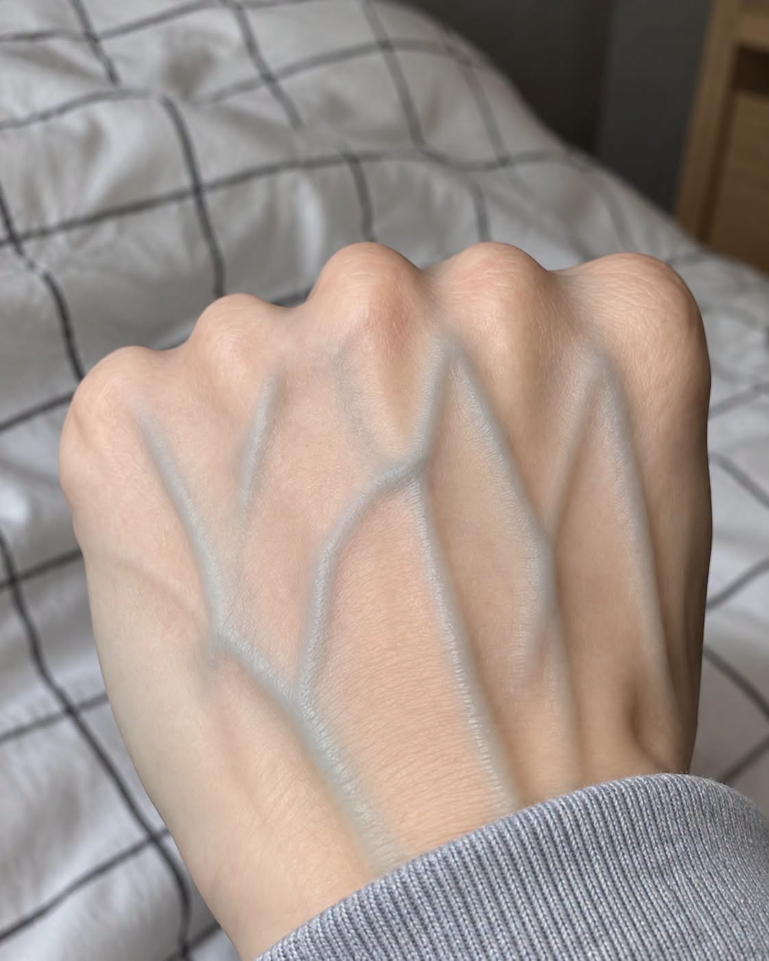 Why Are Your Veins Suddenly More Visible? The Surprising Truth
